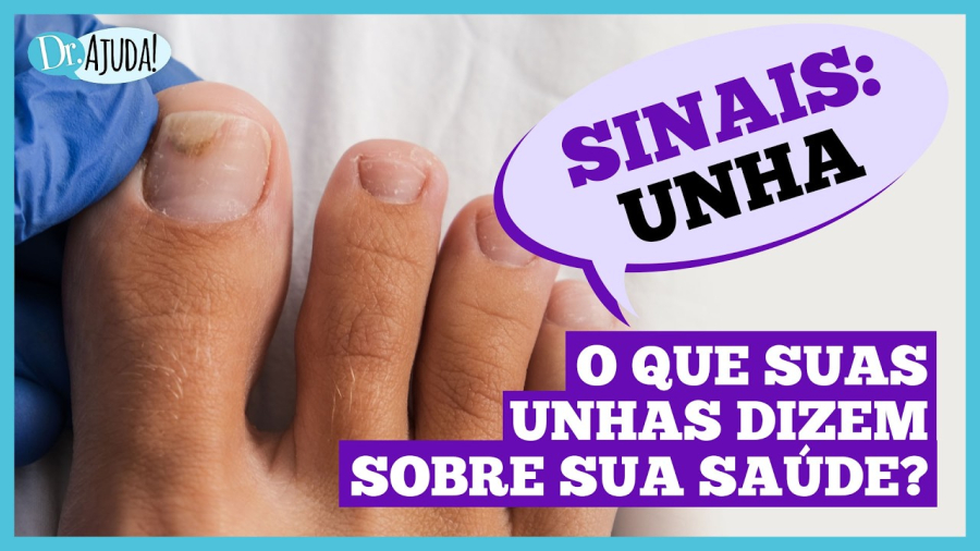 Unhas fracas podem indicar problemas de saúde